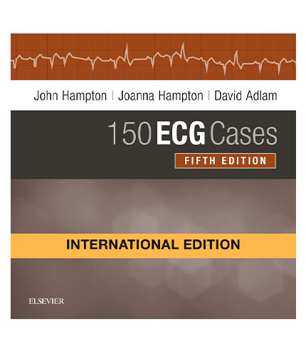150 ECG Cases by Hampton
