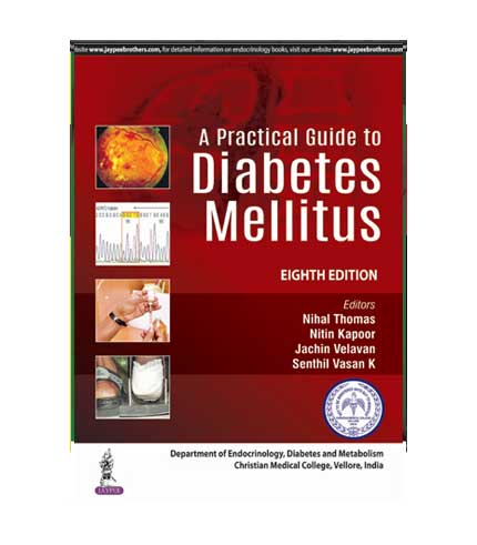 A Practical Guide to Diabetes Mellitus by Nihal Thomas