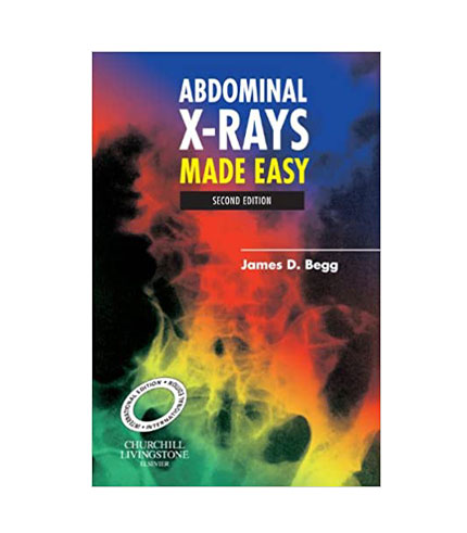 Abdominal X-Rays Made Easy, International Edition, 2e