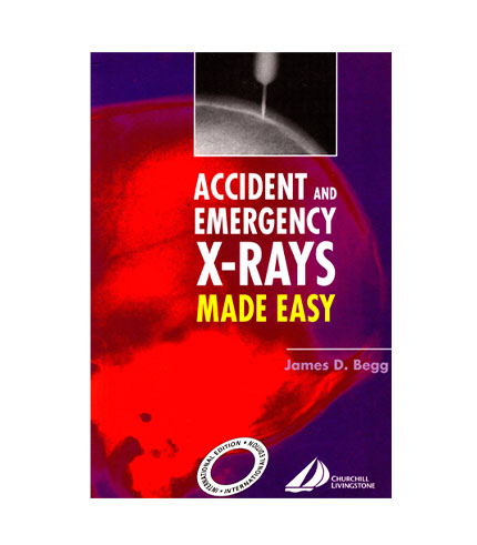 Accident and Emergency X-rays Made Easy, International Edition, 1e