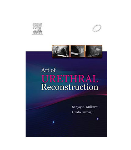 Art of Urethral Reconstruction, 1e