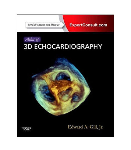 Atlas of 3D Echocardiography: Expert Consult - Online and Print, 1e