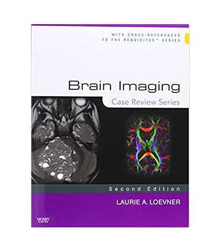 Brain Imaging: Case Review Series, 2e