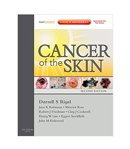 Cancer of the Skin: Expert Consult - Online and Print , 2e
