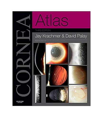Cornea Atlas: Expert Consult - Online and Print, 3e