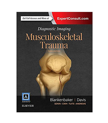 Diagnostic Imaging: Musculoskeletal Trauma, 2e