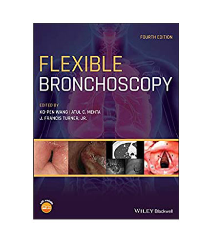 Flexible Bronchoscopy, 4e (HB)