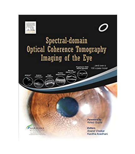 Spectral Domain Optical Coherence Tomography Imaging of the Eye, 1e