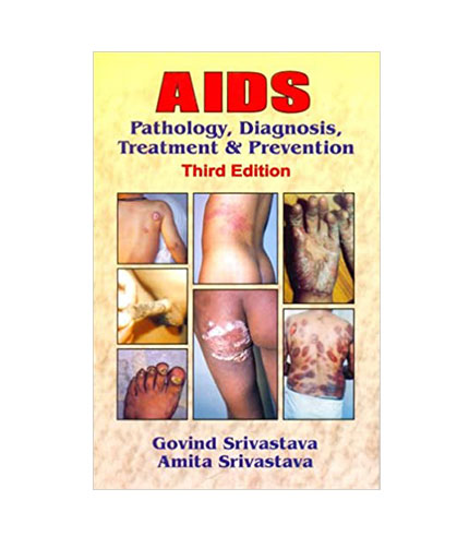 AIDS: Pathology, Diagnosis, Treatment and Prevention
