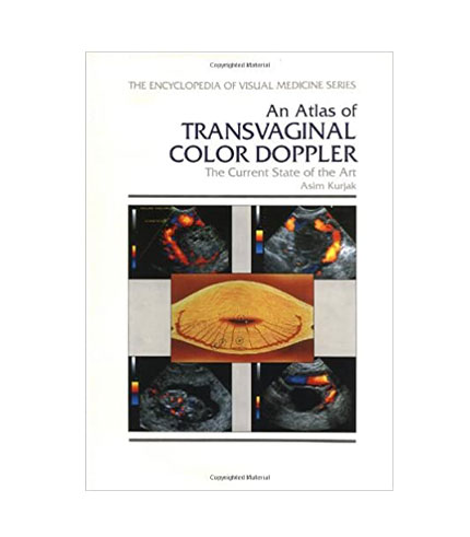 An Atlas of Transvaginal Color Doppler: The Current State of the Art