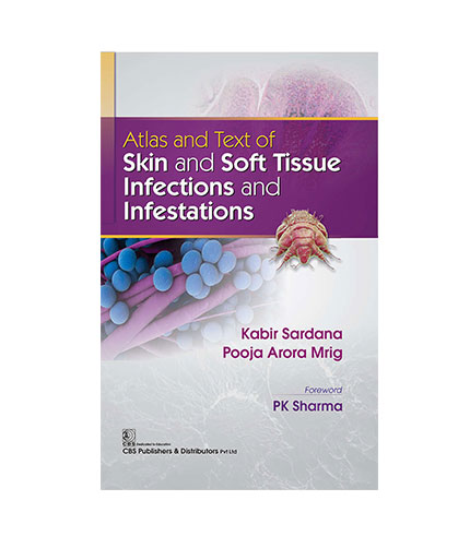 Atlas and Text of Skin and Soft Tissue Infections and Infestations (HB)