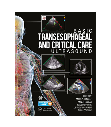 Basic Transesophageal and Critical Care Ultrasound (PB)