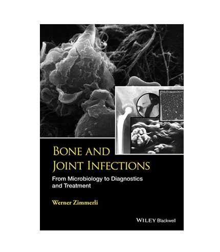 Bone & Joint Infections: From Microbiology to Diagnostics & Treatment (HB)