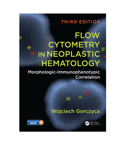 Flow Cytometry In Neoplastic Hematology Morphologic Immunophenotypic Correlation