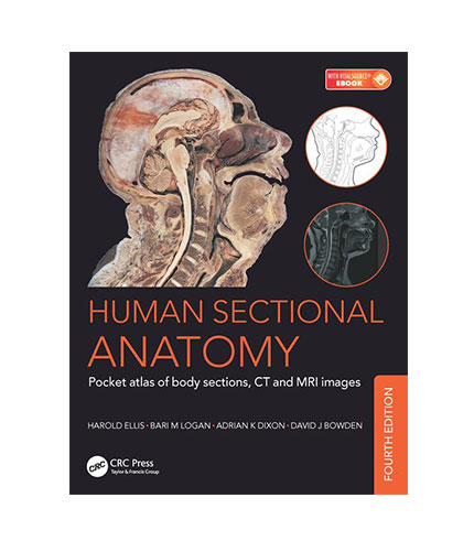 Human Sectional Anatomy: Pocket atlas of body sections, CT and MRI images