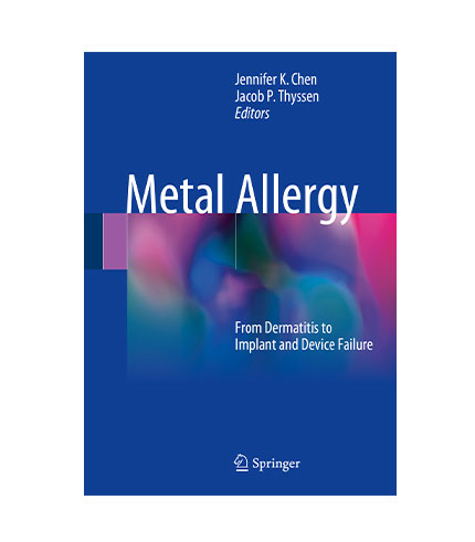 Metal Allergy