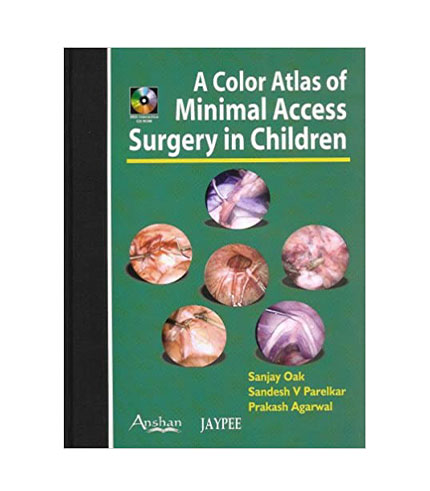 Color Atlas of Minimal Access Surgery in Children