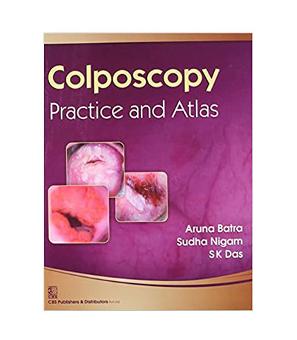 Colposcopy-Practice and Atlas