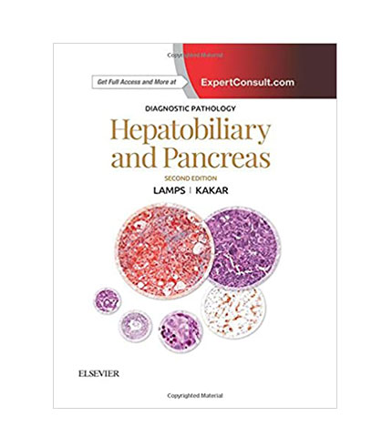 Diagnostic Pathology: Hepatobiliary and Pancreas, 2e
