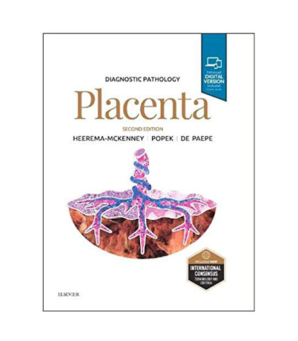 Diagnostic Pathology: Placenta, 2e