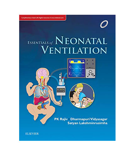 Essentials of Neonatal ventilation, 1e