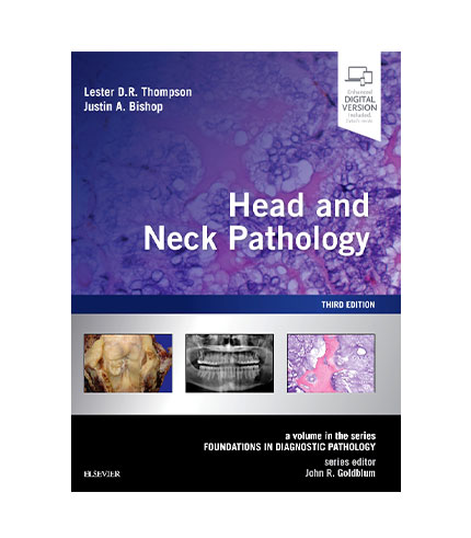 Head and Neck Pathology : A Volume in the Foundations in Diagnostic Pathology Series (Expert Consult - Online and Print), 3e