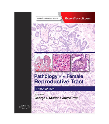 Pathology of the Female Reproductive Tract, 3e