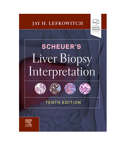 Scheuer's Liver Biopsy Interpretation, 10e