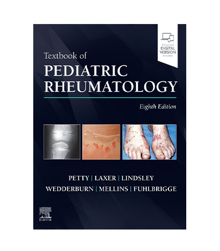 Textbook of Pediatric Rheumatology, Edition 8