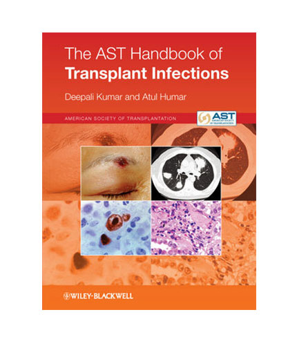 The Ast Handbook of Transplant Infections