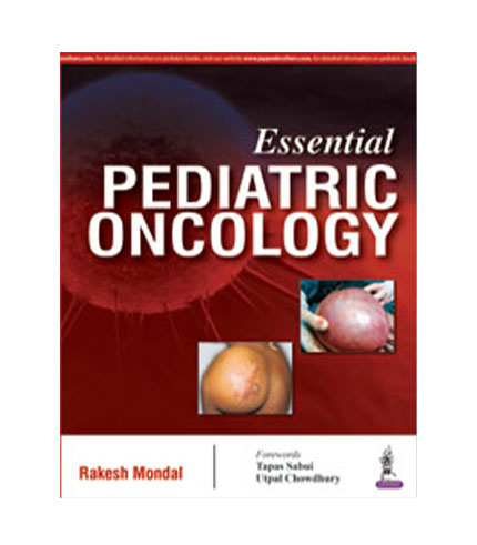 Essential Pediatric Oncology