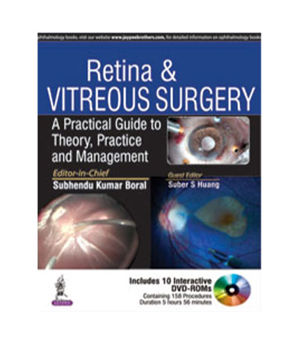 Retina & Vitreous Surgeryâ€”A Practical Guide to Theory Practice and Management (Includes Interactive DVD-ROMs)