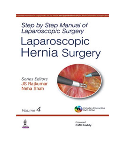 Step by Step Manual of Laparoscopic Hernia Surgery (Volume 4)