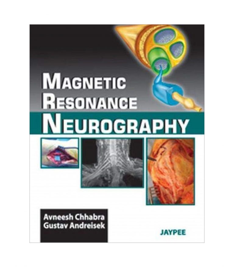 Magnetic Resonance Neurography by Avneesh Chhabra