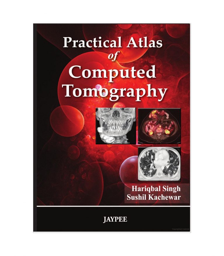 Practical Atlas of Computed Tomography by Hariqbal Singh