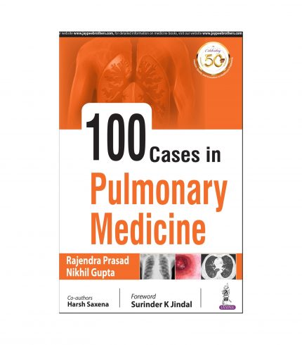 100 Cases in Pulmonary Medicine