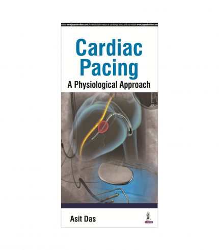Cardiac Pacing: A Physiological Approach