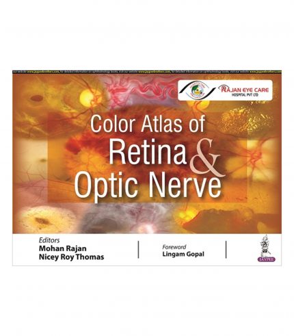 Color Atlas of Retina & Optic Nerve by Mohan Rajan