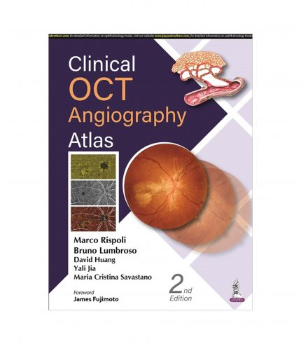 Clinical OCT Angiography Atlas