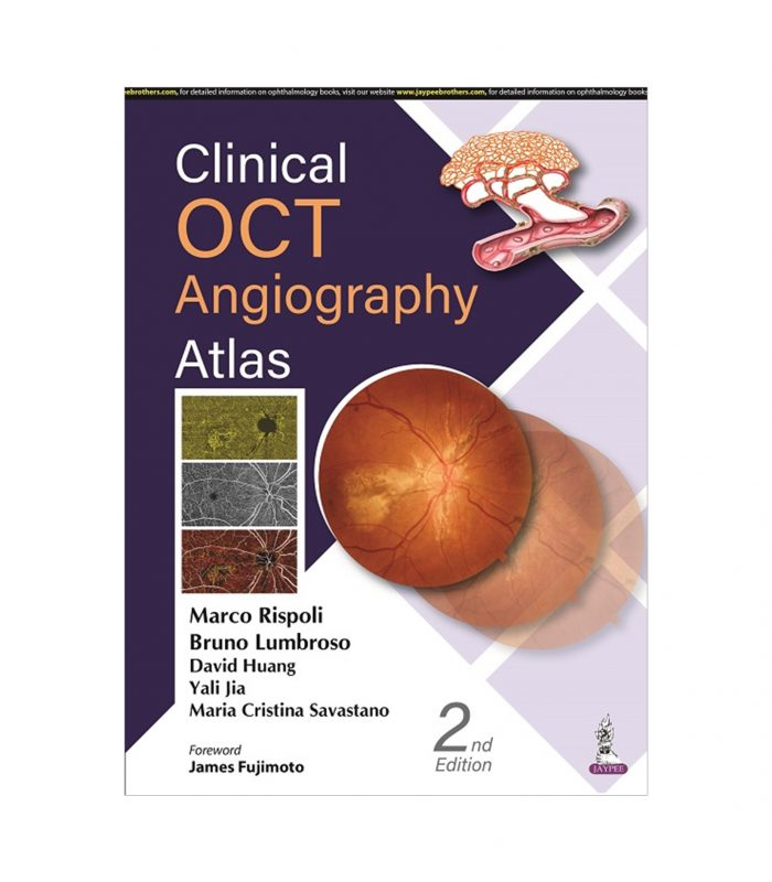 Clinical OCT Angiography Atlas - Image 1