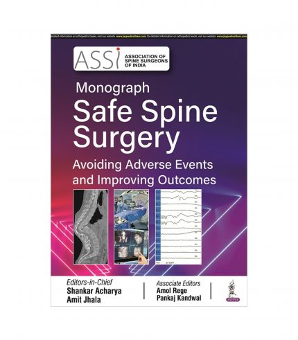ASSI Monograph Safe Spine Surgery: Avoiding Adverse Events and Improving Outcomes