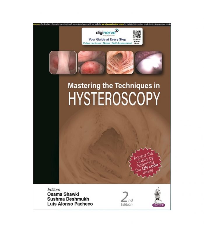 Mastering the Techniques in Hysteroscopy - Image 1