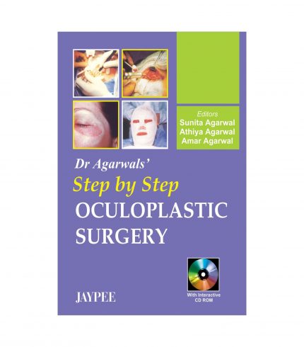 Dr Agarwal's Step by Step Oculoplastic Surgery