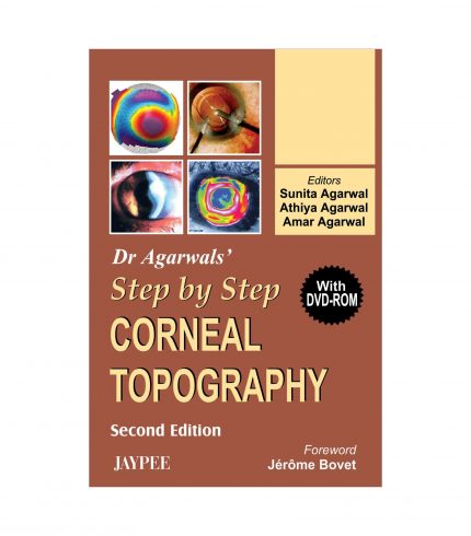 Dr Agarwal's Step by Step Corneal Topography with DVD-ROM by Sunita Agarwal