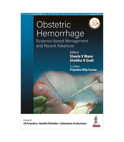 Obstetric Hemorrhage - Evidence Based Management and Recent Advances ...