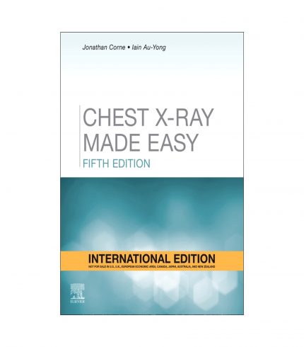 Chest X-Ray Made Easy by Corne, 5th Edition