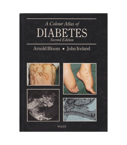 9780723409724 Bloom A Colour Atlas of Diabetes