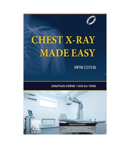 Chest X-Ray Made Easy by Jonathan Corne