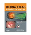 Retina Atlas: A Global Perspective with DVD-ROM