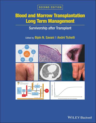 Blood and Marrow Transplantation Long Term Management: Survivorship after Transplant by Bipin N. Savani and Andre Tichelli, 2e (HB)